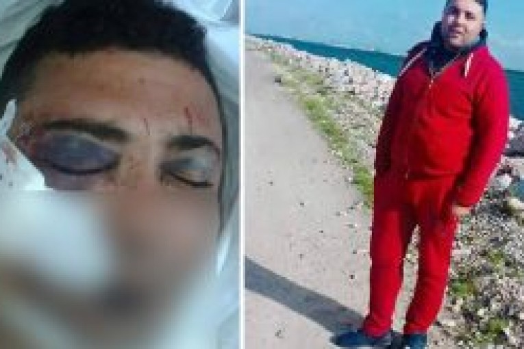 دخل في غيبوبة اثر تعرّضه للعنف: عائلة شاب تتهم أعوان الأمن.. والنقابة تنفي