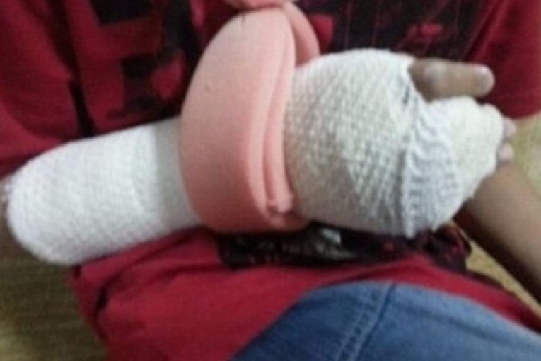 القيروان: بسبب خطأ في الرسم… معلمة تكسر أصابع تلميذتها