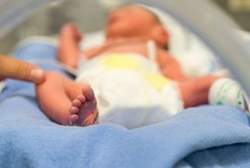 فرنسا: قلق كببير بسبب ولادة أطفال بدون أطراف