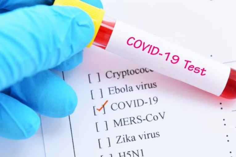 وزارة الصحة: تسجيل 3 إصابات وافدة بكورونا ولا وفيات