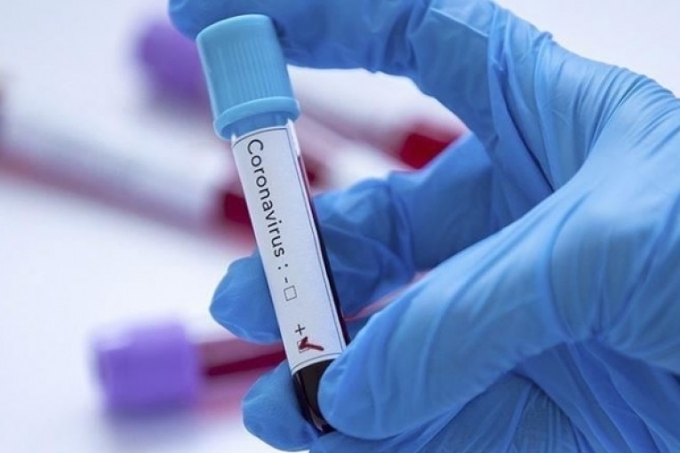 تسجيل 5 إصابات جديدة وافدة بكورونا