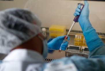 منظمة الصحة العالمية : قد لا يكون هناك “حل سحري” لعلاج أزمة تفشي فيروس كورونا، رغم المساعي الدولية لتطوير لقاح ضد الوباء.