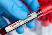 الكاف: تسجيل 09 إصابات محليّة جديدة بفيروس “كورونا” من مجموع 14 تحليلا