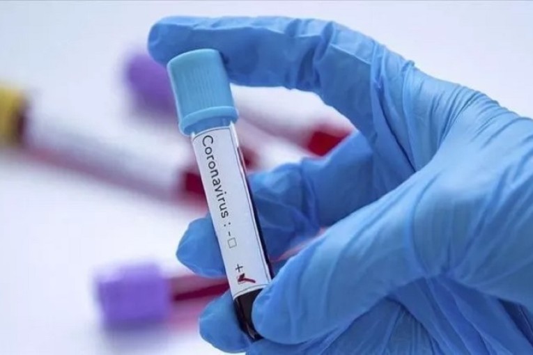 سليمان: تسجيل 28 حالة إصابة بالكورونا من بينهم طبيبة