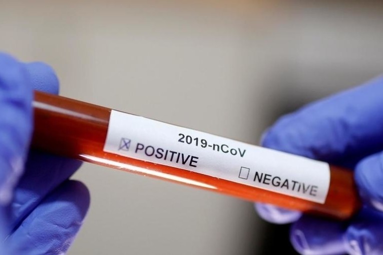 القصرين: تسجيل حالة وفاة جديدة ب”كوفيد19″ وارتفاع اجمالي الوفيات الى 14 حالة