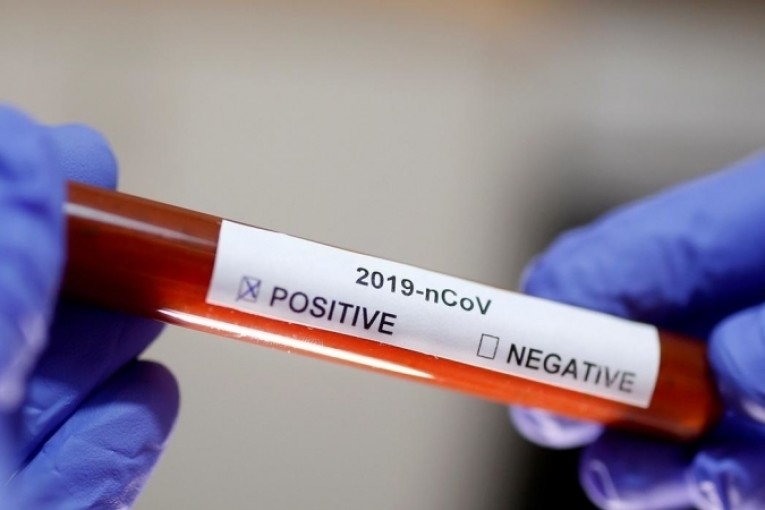 قابس : تسجيل حالة وفاة و04 اصابات جديدة بكورونا