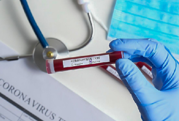 وزارة الصحة : تسجيل 49 وفاة و1314 اصابة جديدة بفيروس كورونا
