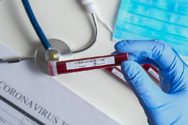 وزارة الصحة : تسجيل 49 وفاة و1314 اصابة جديدة بفيروس كورونا