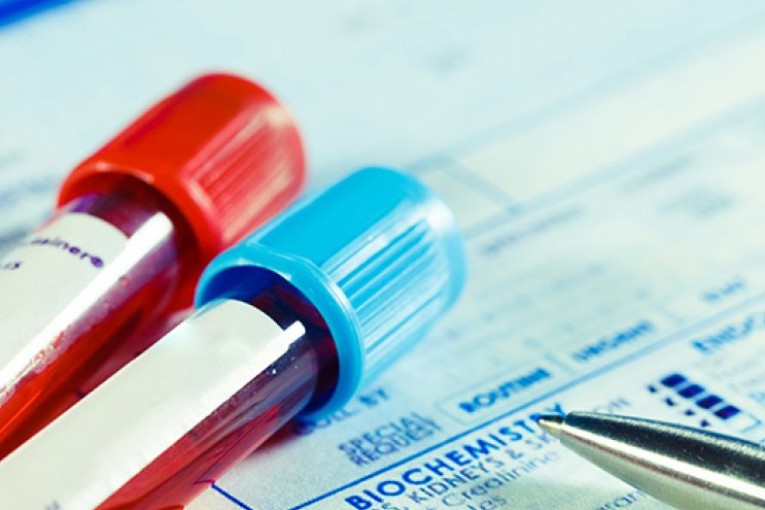 37 حالة وفاة و1069 إصابة جديدة بفيروس كورونا