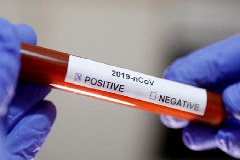 قابس: تسجيل 05 حالات وفاة و39 اصابة جديدة بفيروس “كورونا”