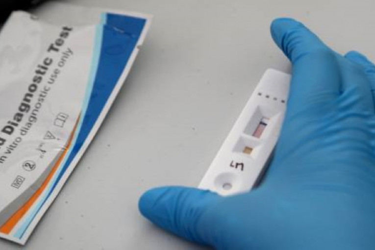 وزير الصحة: تحليل تقصي كورونا بسعر 20 دينارا للعموم بالصيدليات