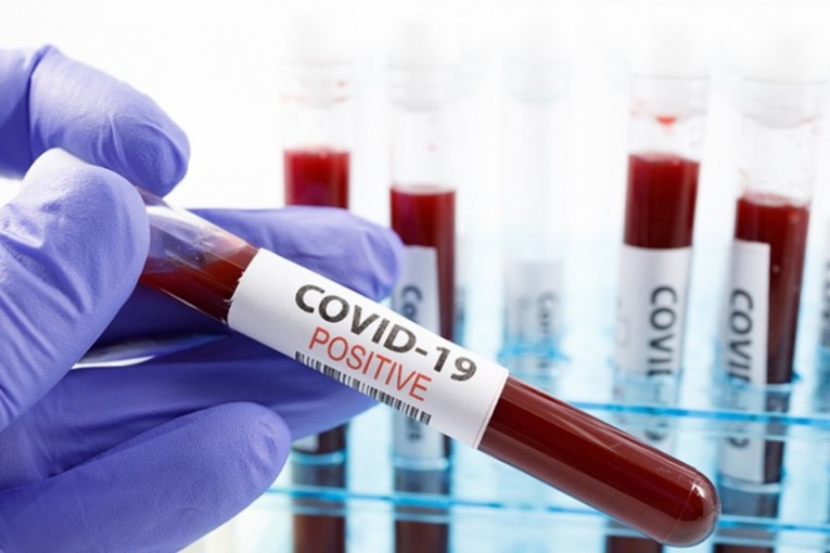 وزارة الصحة: تسجيل 73 وفاة و1925 إصابة جديدة بفيروس كورونا