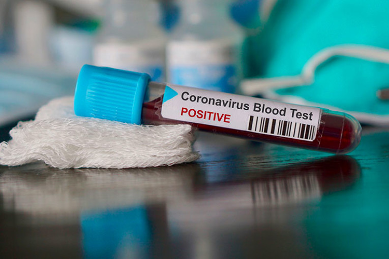 قابس: 91 اصابة جديدة بفيروس كورونا