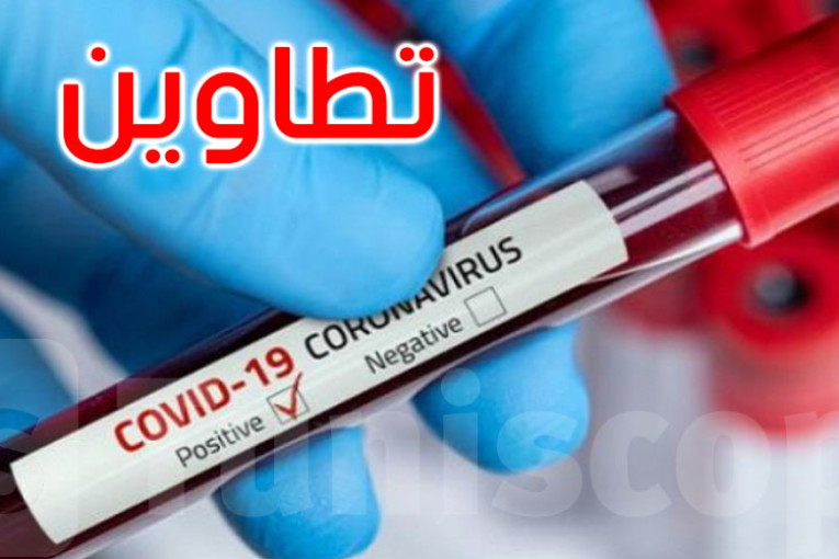 تطاوين: تحسن في الوضع الوبائي وعدم تسجيل حالات وفاة جديدة بفيروس “كورونا”