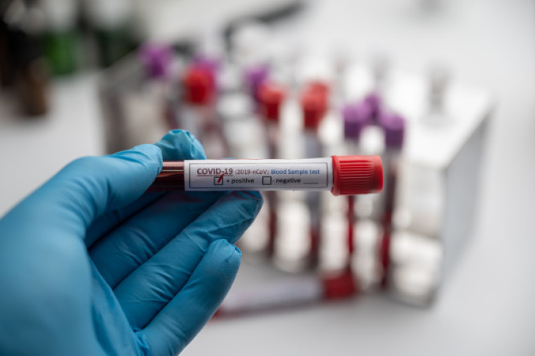 صفاقس-كوفيد19: استقرار في إجمالي الوفيات لليوم الثاني على التوالي