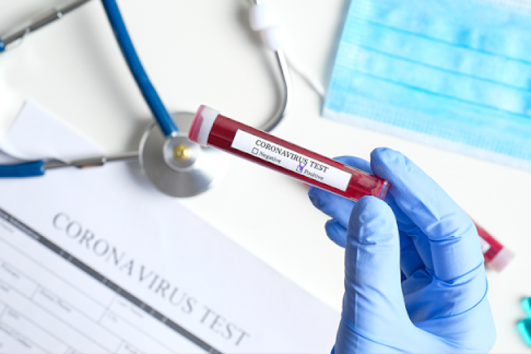 القيروان: ارتفاع نسبة التحاليل الايجابية لفيروس كورونا بأولاد فرج الله إلى 36%