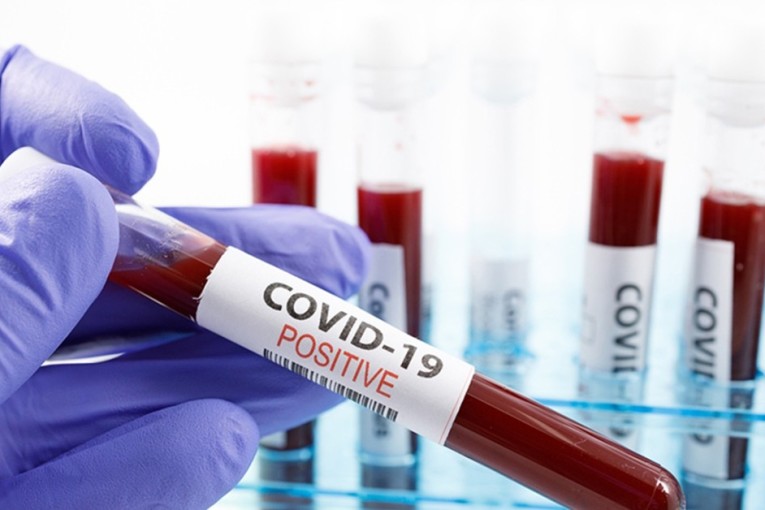 مدنين: تسجيل حالة وفاة و36 اصابة محلية جديدة وغلق قسم اخر باحدى الاعداديات