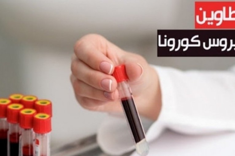 تطاوين: تسجيل حالة وفاة و167 إصابة جديدة بفيروس كورونا