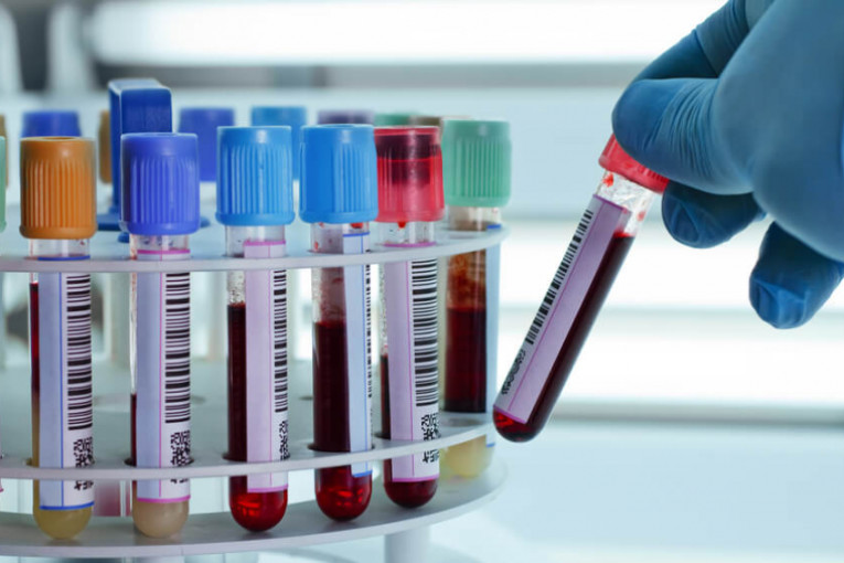 إخضاع 7 تلاميذ تعرضوا للحقن من طرف غرباء لتحاليل مخبرية