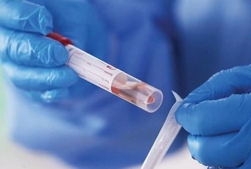 تطاوين: 13 إصابة كورونا في 10 مؤسسات تربوية‎‎