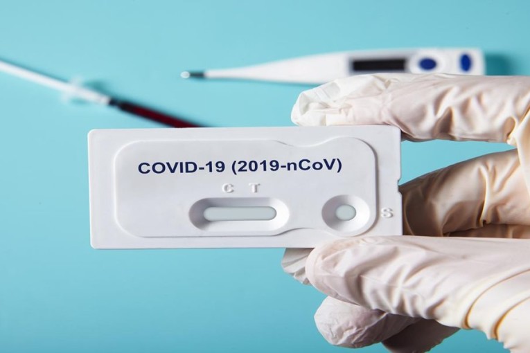 جمعية الصيادلة: بيع التحاليل السريعة لكورونا عبر الانترنات قد تكون له نتائج صحية وخيمة