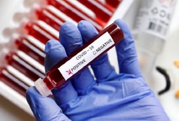 قابس : تسجيل 78 اصابة جديدة بفيروس “كورونا”