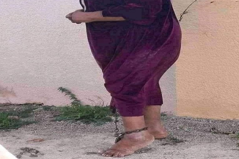 نابل: التدخل لفائدة امرأة تعمّدت عائلتها تقييدها بالسلاسل