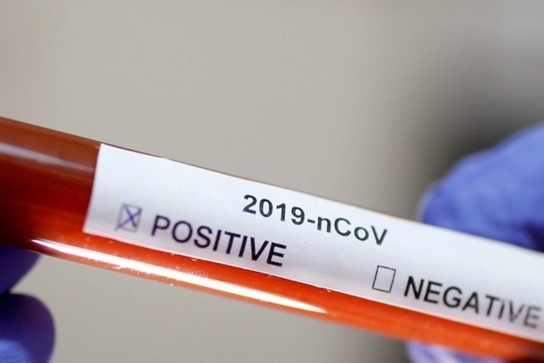 كورونا: 11 حالة وفاة و1170 إصابة جديدة