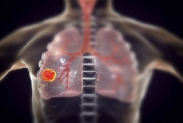 أستاذ في طب الأورام : ‘إقبال لافت للنساء على التدخين..’