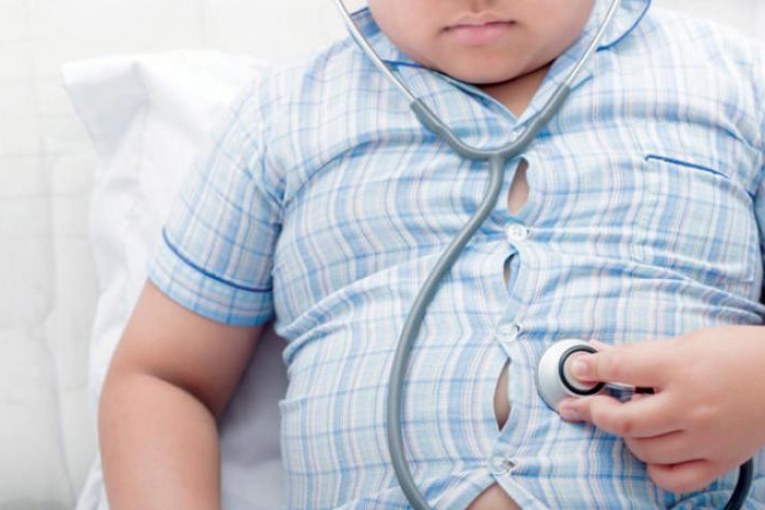 معهد التغذية: إصابة 17% من الأطفال أقل من 5 سنوات بالسمنة