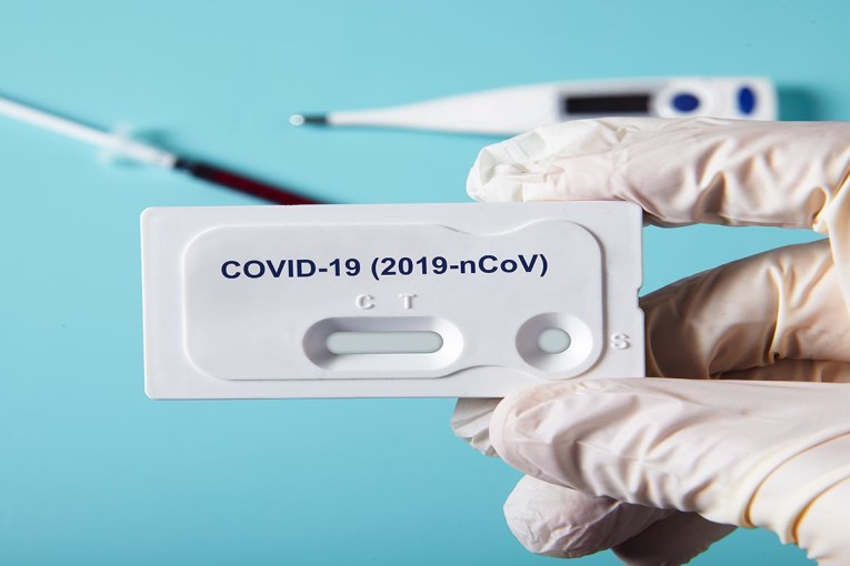 منظمة الصحة العالمية تحذّر من تراجع عدد اختبارات الكشف عن فيروس كورونا