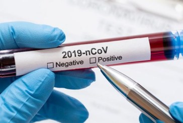 باجة: إصابة واحدة بكورونا وصفر حالة نشيطة بـ3 معتمديات