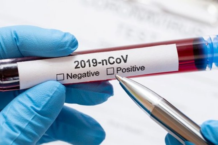 باجة: إصابة واحدة بكورونا وصفر حالة نشيطة بـ3 معتمديات