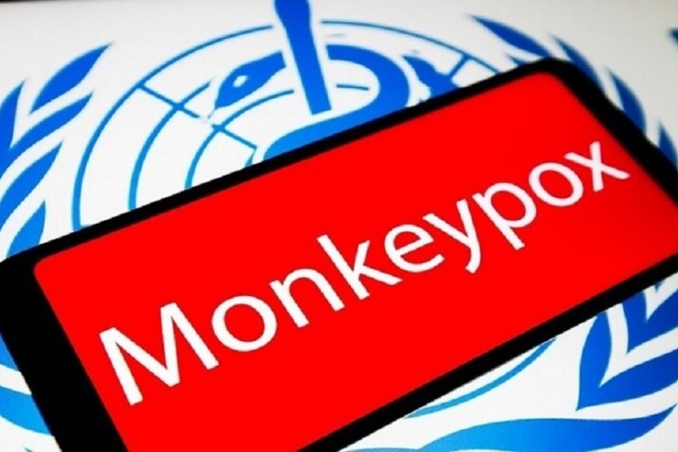 ابتكار أوّل نظام اختبار لتشخيص ‘جدري القردة’ في العالم