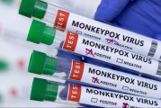 الصحة العالمية: 780 إصابة بجدري القردة في 27 دولة