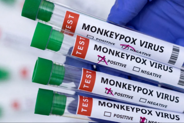 الصحة العالمية: 780 إصابة بجدري القردة في 27 دولة