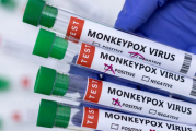 جدري القردة: منظمة الصحة العالمية تدعو إلى اليقظة والشفافية