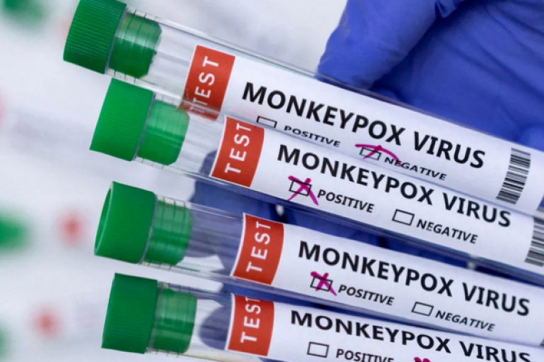 جدري القردة: منظمة الصحة العالمية تدعو إلى اليقظة والشفافية