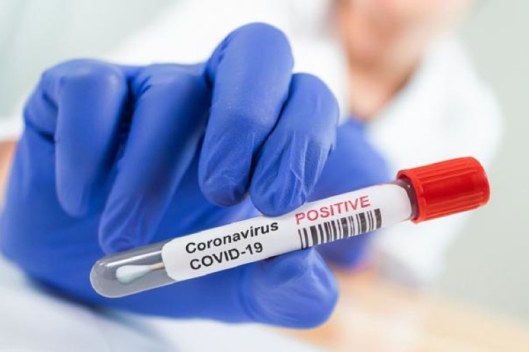 قابس: 148 إصابة جديدة بكورونا