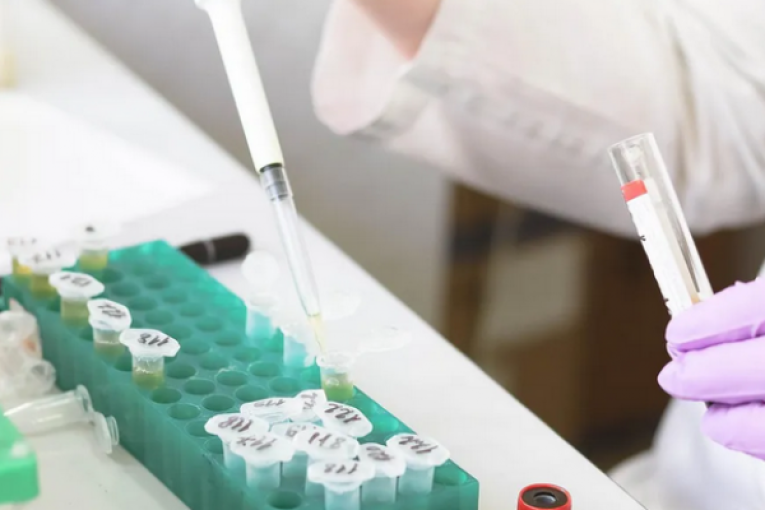 الدكتور العوني: ‘لم يتم التبليغ عن أية حالة لجدري القردة بتونس والوزارة تراقب عن كثب تطور الوضع’