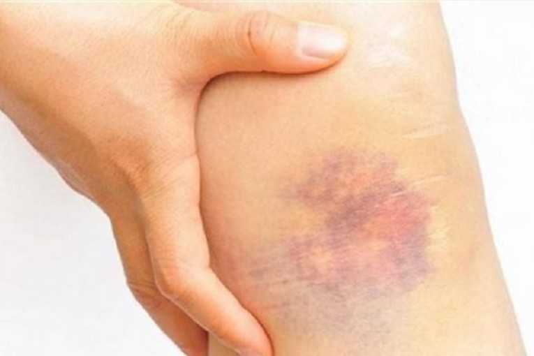 الدكتور الغزال: بشرى للمصابين بهذا المرض