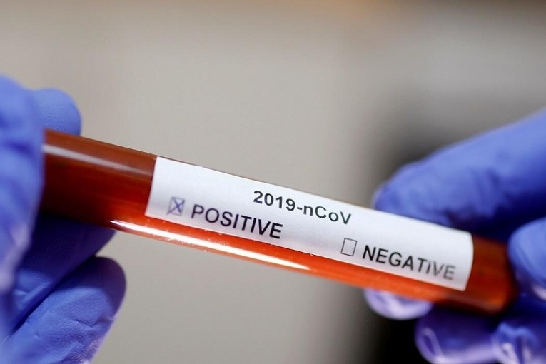 تطاوين: حالة وفاة و97 إصابة جديدة بكورونا