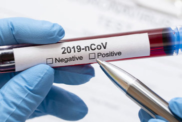 من جملة 7 عينات: 4 إصابات بكورونا في صفوف حجيج ولايتي مدنين وتطاوين