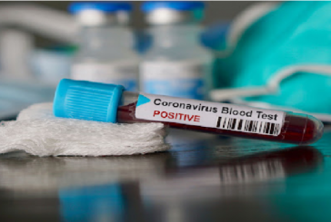 صفاقس: 107 إصابات جديدة بكورونا