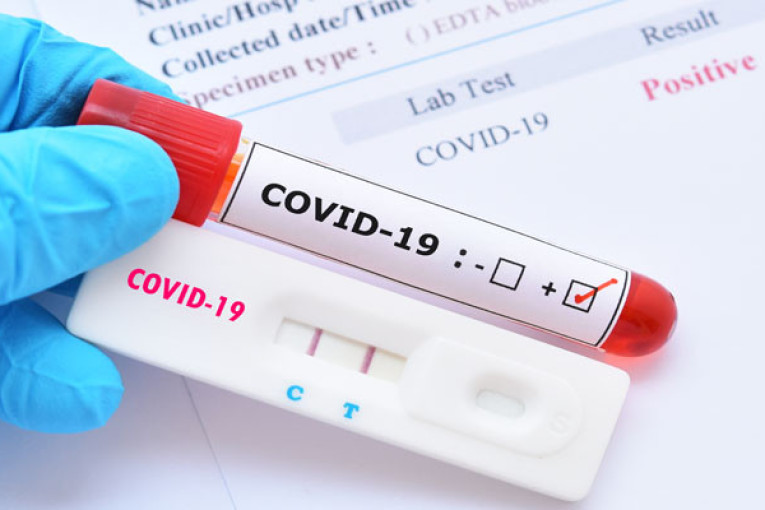 سوسة: 85 إصابة جديدة بكورونا