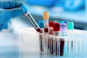 لمن هم فوق الـ50.. فحص دم يكشف 50 نوعاً من السرطان قبل ظهور الأعراض