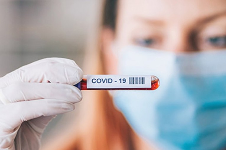 6 وفيات و195 إصابة جديدة بكورونا خلال أسبوع واحد