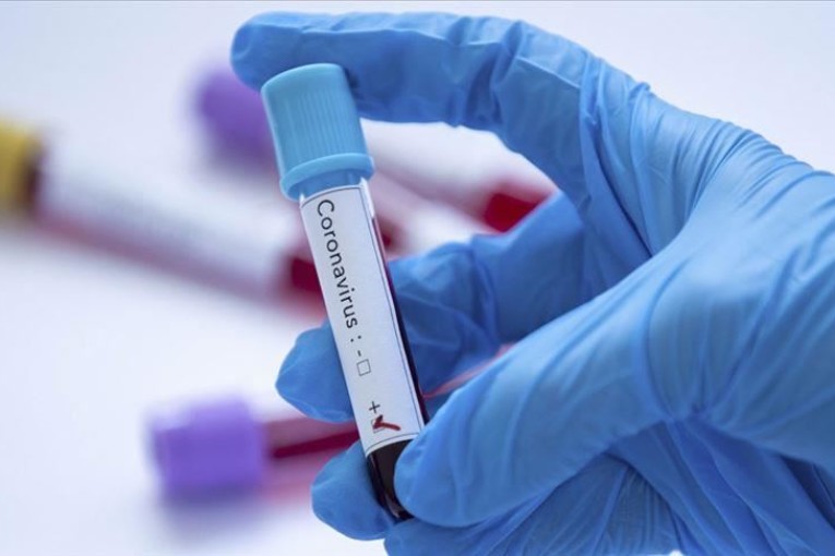 5 حالات وفاة و94 إصابة بالكورونا خلال أسبوع