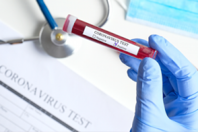 الوضع الوبائي: 78 إصابة و4 وفيات خلال الاسبوع الفارط