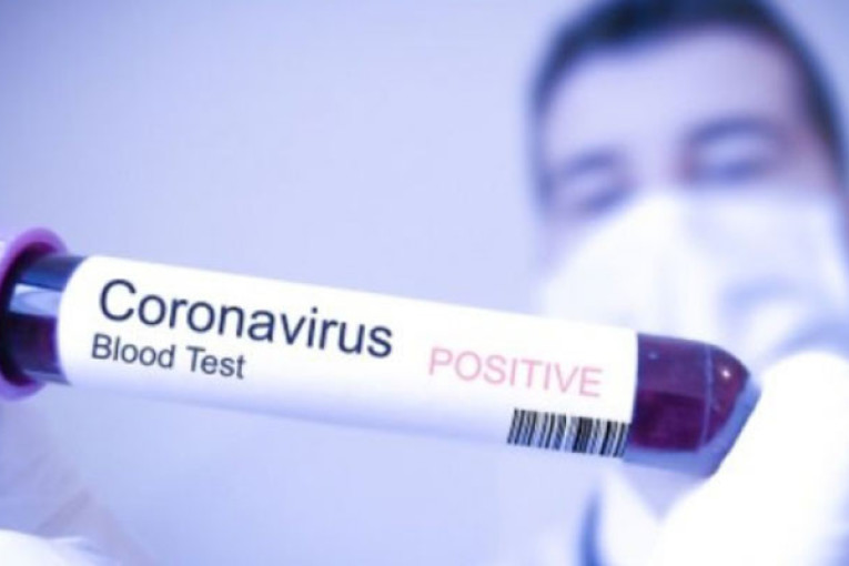 الوضع الوبائي: 78 إصابة و4 وفيات في الاسبوع الفارط